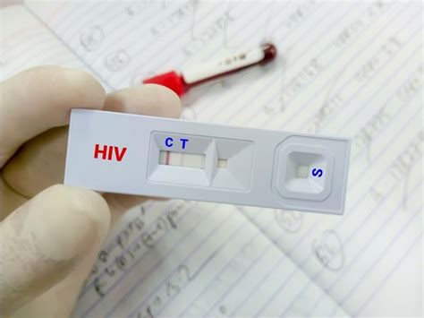 How Much Are Hiv Test