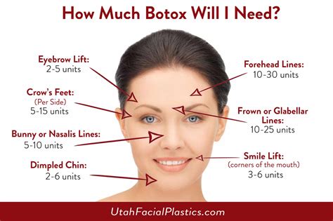 how much botox cost