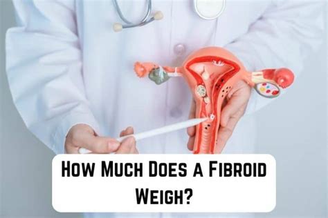 how much does a 10cm fibroid weigh