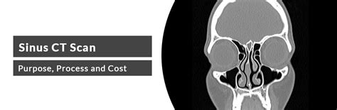 How Much Does A Ct Scan Cost For Sinus