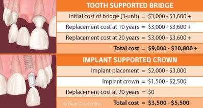 how much does a dental implant bridge cost