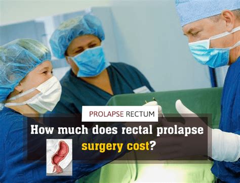 How Much Does A Prolapse Operation Cost Privately