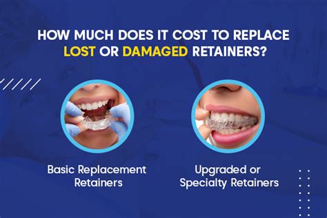 How Much Does A Retainer Cost To Replace