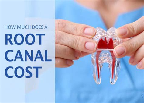 how much does a root canal and crown usually cost