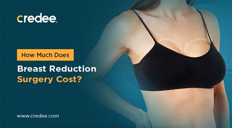 How Much Does Chest Reduction Cost