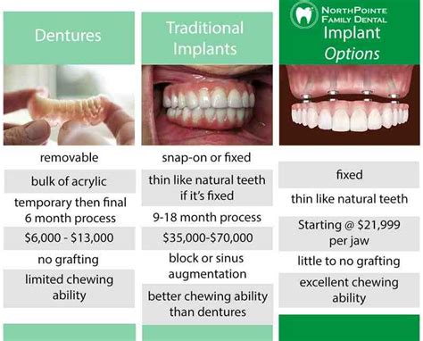 How Much Do Upper Dental Implants Cost? A Comprehensive Guide to Pricing & Value