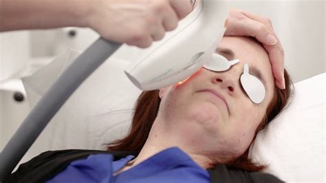 how much is ipl at florida eye specialists