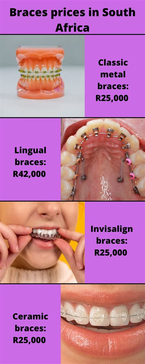 how much is to put braces in south africa