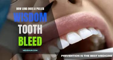 How Much Should A Pulled Tooth Bleed