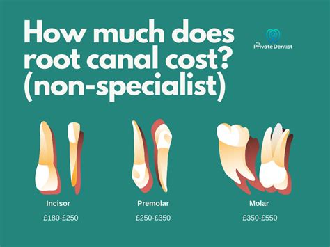 how much should a root canal cost uk
