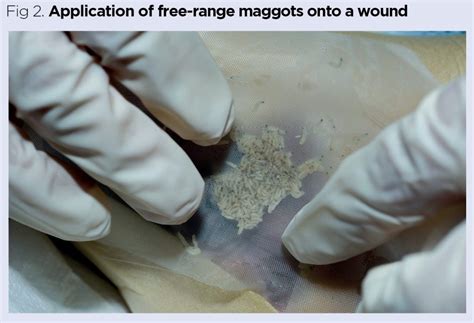 How Quickly Can Maggots Appear In A Wound