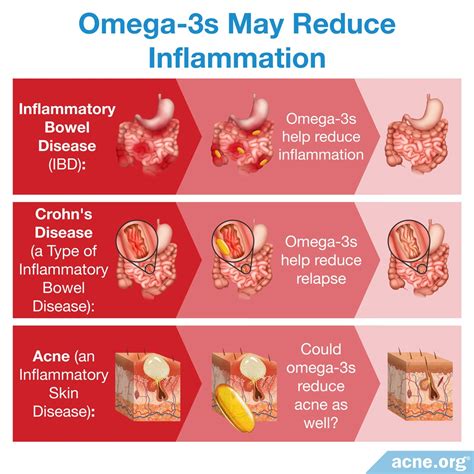 How Quickly Does Omega-3 Reduce Inflammation