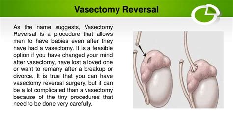 Reversing Vasectomy: How Reversible Are Vasectomies Really?