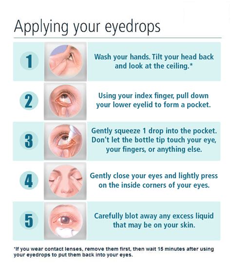 how to administer glaucoma eye drops