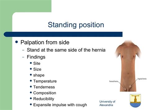 how to assess inguinal hernia