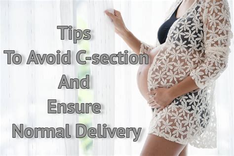How To Avoid C Section Reddit