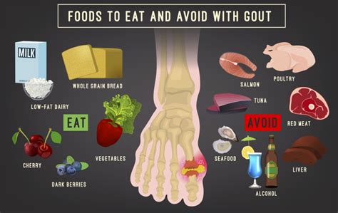 how to avoid getting gout