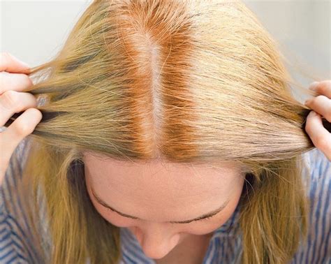 How To Avoid Ginger Roots With Blonde Dye
