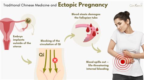 how to avoid second ectopic pregnancy