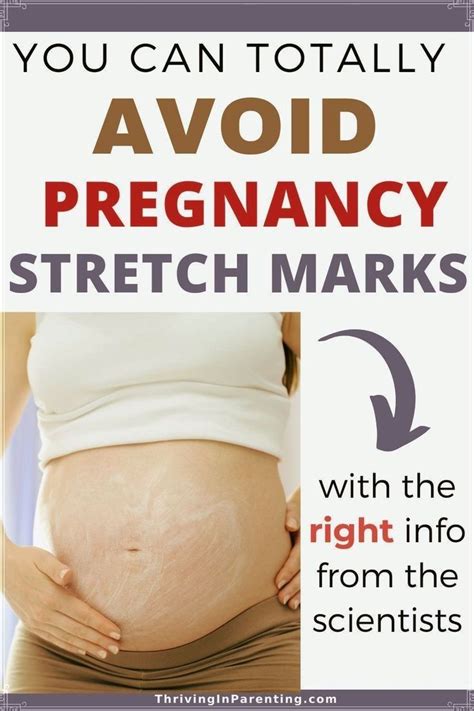 how to avoid stretch marks in third trimester
