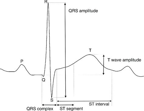 how to calculate amplitude of a wave ecg