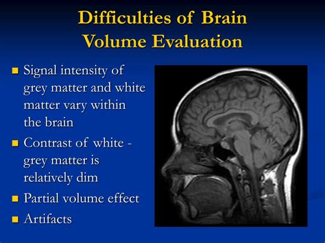 how to calculate brain size