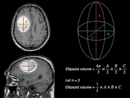 how to calculate brain volume