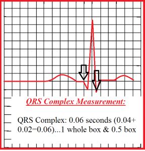 how to calculate qrs complex amplitude