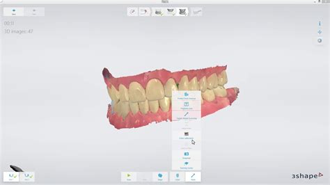 How To Calibrate 3Shape Trios