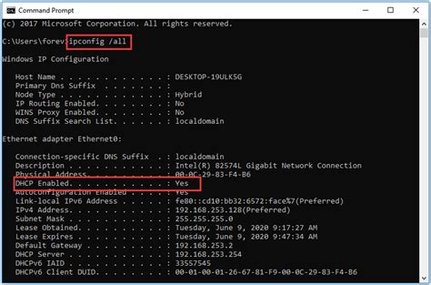 how to check if ip is static or dynamic windows