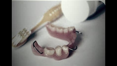How To Clean A Removable Partial Denture