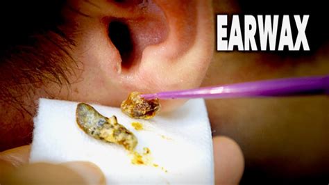 how to clean earwax safely