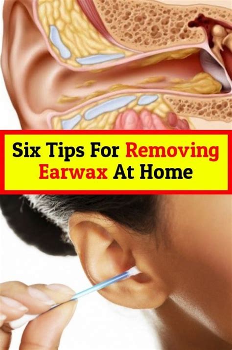 how to clear sticky ear wax