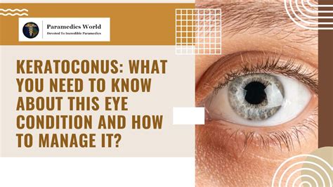 how to correct keratoconus