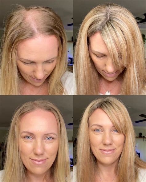How To Cover Thin Hair With Extensions