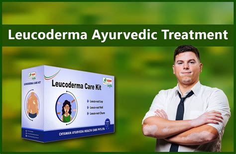 How To Cure Leucoderma