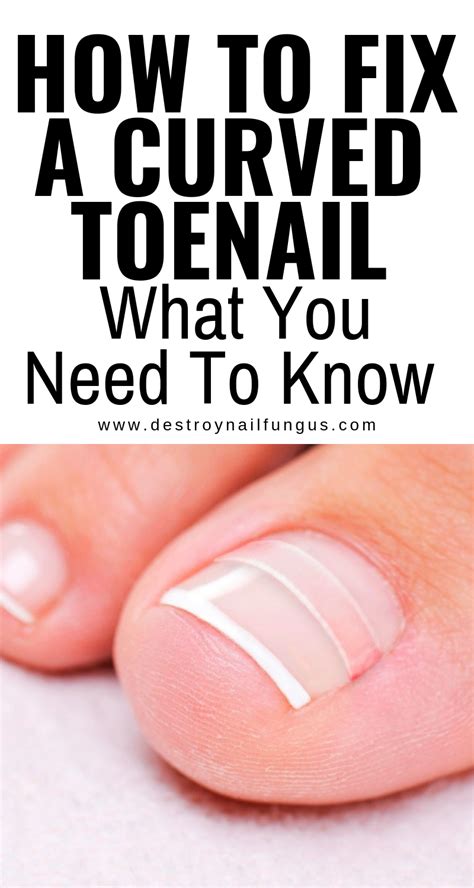 how to cut a curved toenail