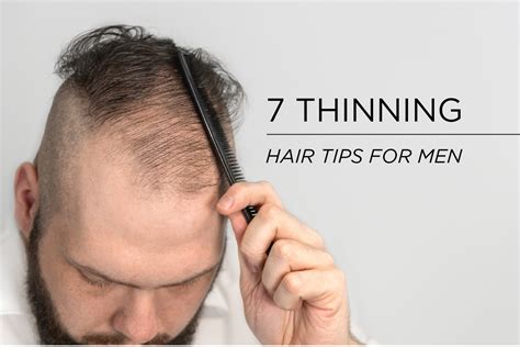 How To Deal With Thinning Hair Male Reddit