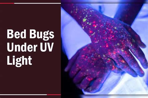 how to detect bed bugs with uv light