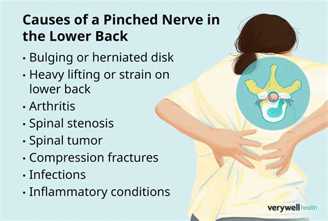 how to detect pinched nerve in lower back