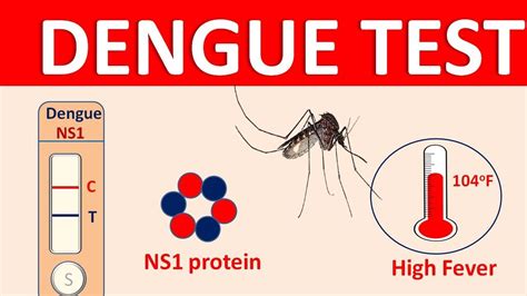 how to diagnose dengue