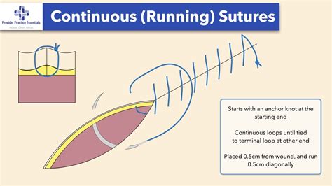 How To Do A Continuous Suture