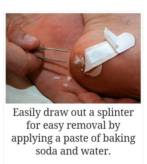 11+ How To Draw Out Splinters New Hutomo