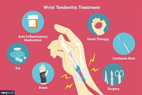 How To Ease Wrist Tendonitis