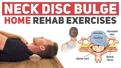 how to exercise with cervical herniated disc