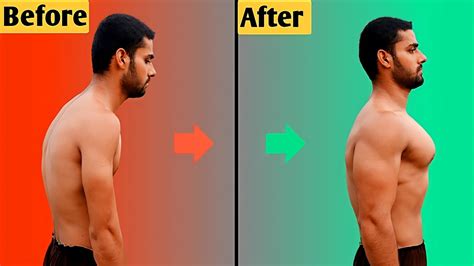How To Fix Back Posture Fast
