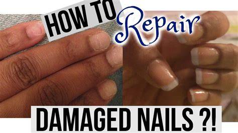 How To Fix Badly Damaged Nails