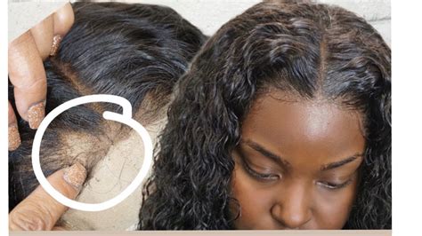How To Fix Balding Lace Wig     Tips And Tricks