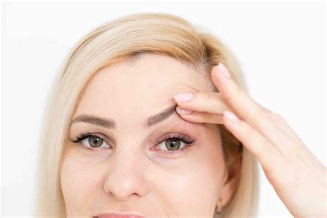 Perfect How To Fix Droopy Eyes From Botox Trend This Years