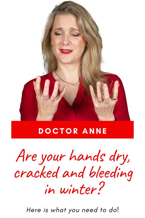 How To Fix Dry Bleeding Hands